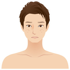 男性　顔　シミそばかす