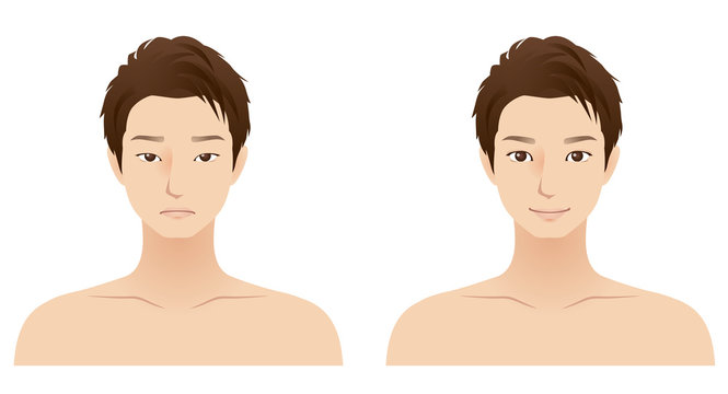 男性　顔　美容整形　二重手術