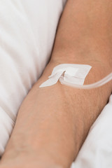 Close-up Of Patient's Hand