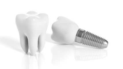 Tooth and dental implant isolated on white background - obrazy, fototapety, plakaty