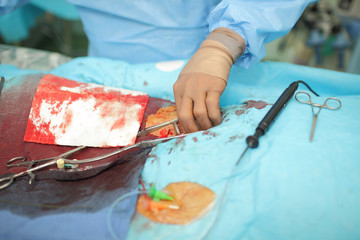 Breakthrough bleeding patient on the operating table