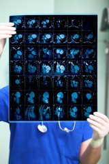 Doctor examines the patient's CT picture
