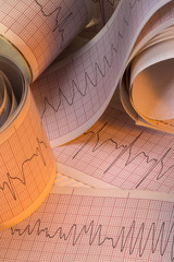 Electrocardiograph Traces - Cardiac Arrhythmia