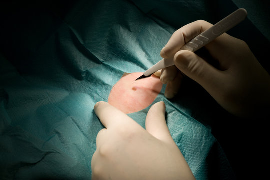 Germany, Surgeon with scalpel