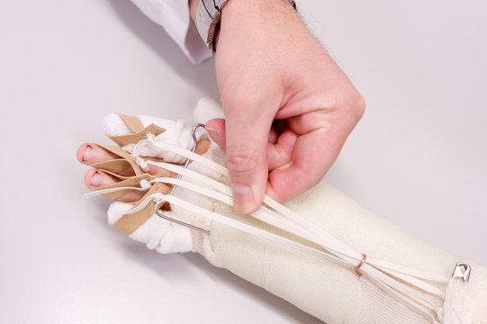 Germany, Berlin, Arm roll gauze wound
