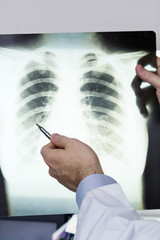 Doctor.Xray of lungs. hospital. medical check. 