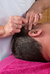 Acupuncturist prepares to tap needle on man's ear
