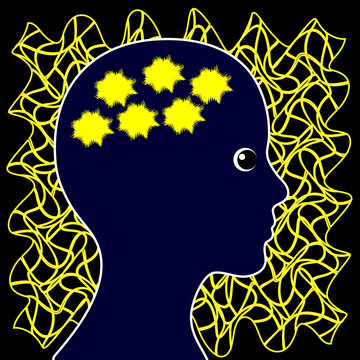 Epileptic Seizure triggerd by specific patterns