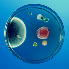 Petri dishes, toned photo