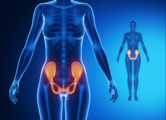 PELVIS blue x--ray bone scan
