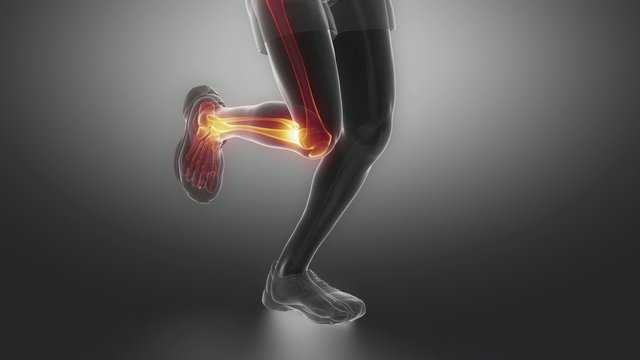 Running man knee scan