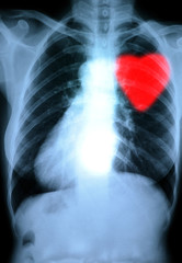 x-ray red heart of human