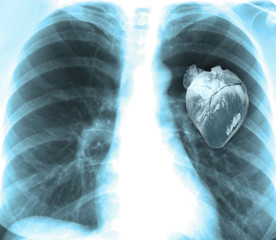 Human x-ray with heart, close-up