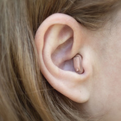 In-the-ear hearing aid in close-up