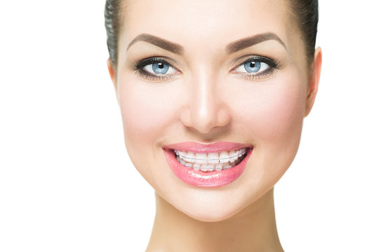 Beautiful woman smiling. Closeup ceramic braces on teeth