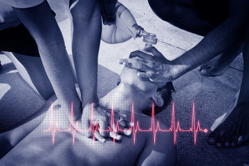 Cardiopulmonary resuscitation (CPR). Cardiogram concept.