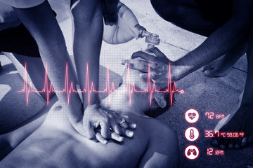 Cardiopulmonary resuscitation (CPR). Cardiogram concept.