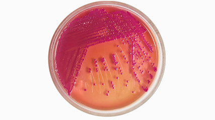 Agar plate with microorganisms on white background
