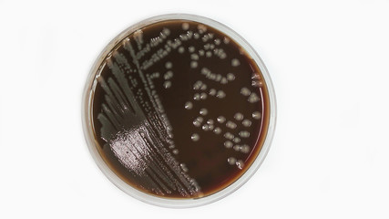 Agar plate with microorganisms on white background