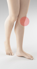 Gambe donna con dolore ginocchio sinistro