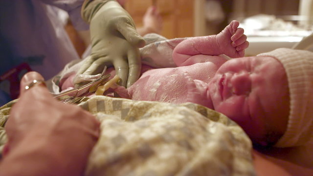 A newborn baby getting its cord cut in the hospital