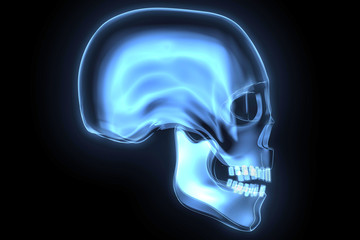 X-ray skull