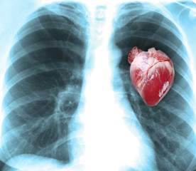 Human x-ray with heart, close-up