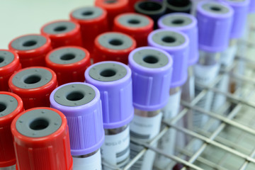 Close up medical test-tube with blood samples