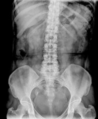 spinal column x-ray image of human