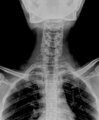 neck isolated on black background