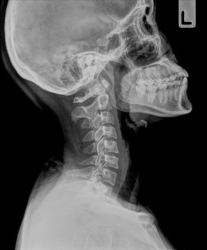 human neck radiography side view
