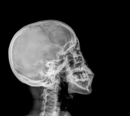 detail of neck and head x-ray image