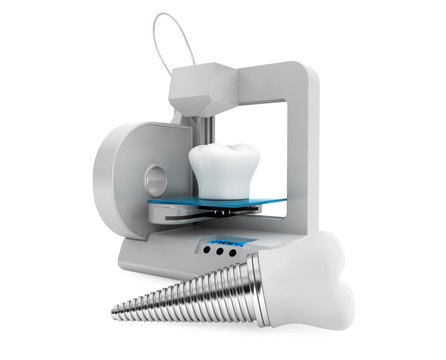 Dental Technology Concept. 3d Printer Printing Tooth Implant