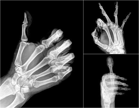 Collection X-ray symbol hands