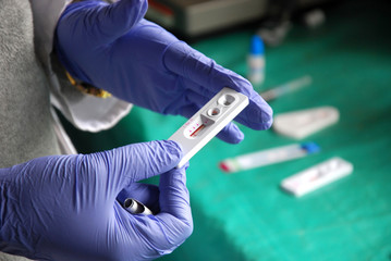HIV test at Pomerini in Tanzania - Africa