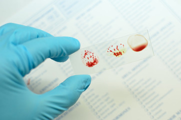 Blood grouping