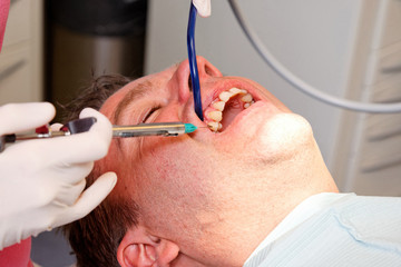 local anesthesia with a syringe between the teeth against pain