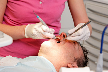 close up of tooth cleaning by a dental hygienist