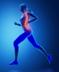 Running womna spine problem concept