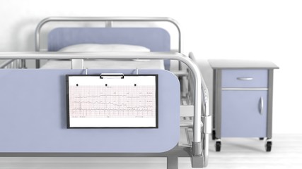 Hospital bed and bedside table with focus on patient sheet cardiogram