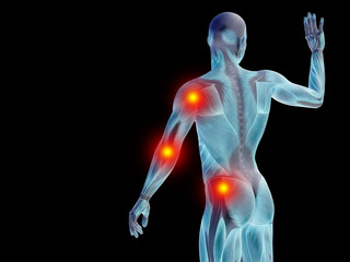 Conceptual human body anatomy pain on black