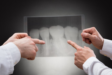 Doctors Examining Dental Xray