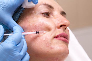 Cosmetic treatment with injection in a clinic