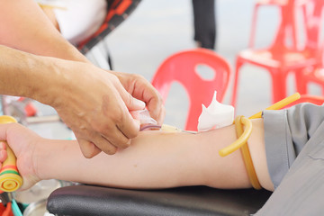 arm of a donor donating blood at hemotransfusion station