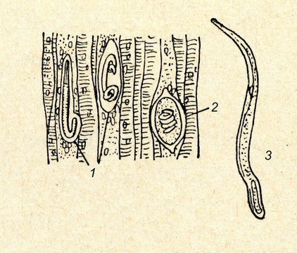 Trichina worm (Trichinella spiralis)