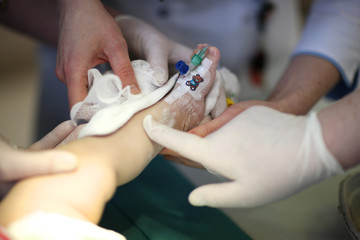 Inserting a catheter in the baby's leg - 84735601