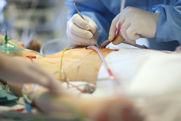 Hands of a surgeon operating acute patient