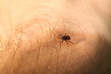 Zecke (Holzbock) - Borreliose / FSME