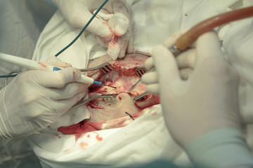 Head surgery