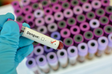 Obraz premium Blood sample with Dengue virus positive
